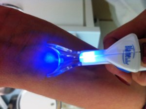 Aparelho VIBRATION ANESTHESIA DEVICE