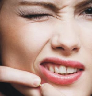 O que causa ou piora a acne?